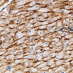 CD36 Antibody (1283D) - Azide and BSA Free, Novus Biologicals 0.1 mg; Unconjugated:Antibodies,